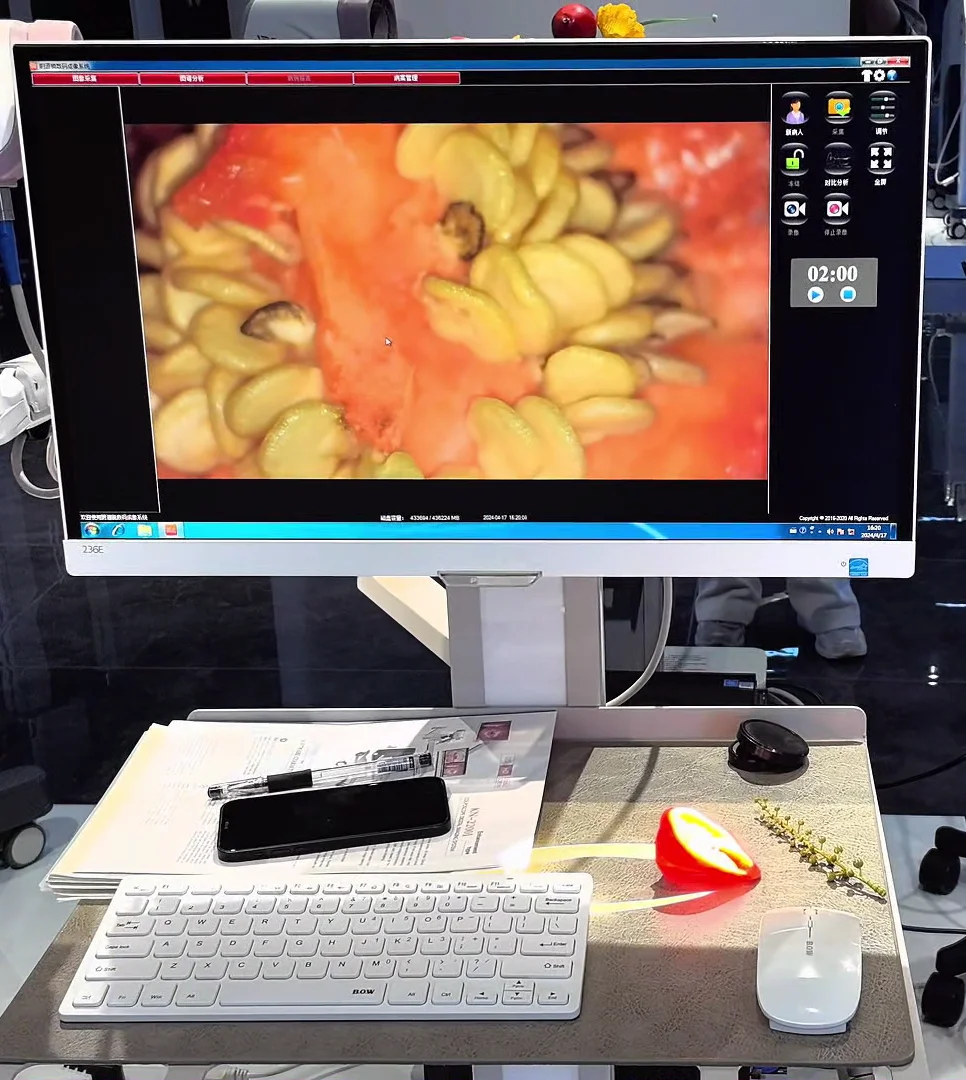 Binocular Colposcopes Equipment Colposcopy Digital Imaging System colposcope digital camera KN-2200B