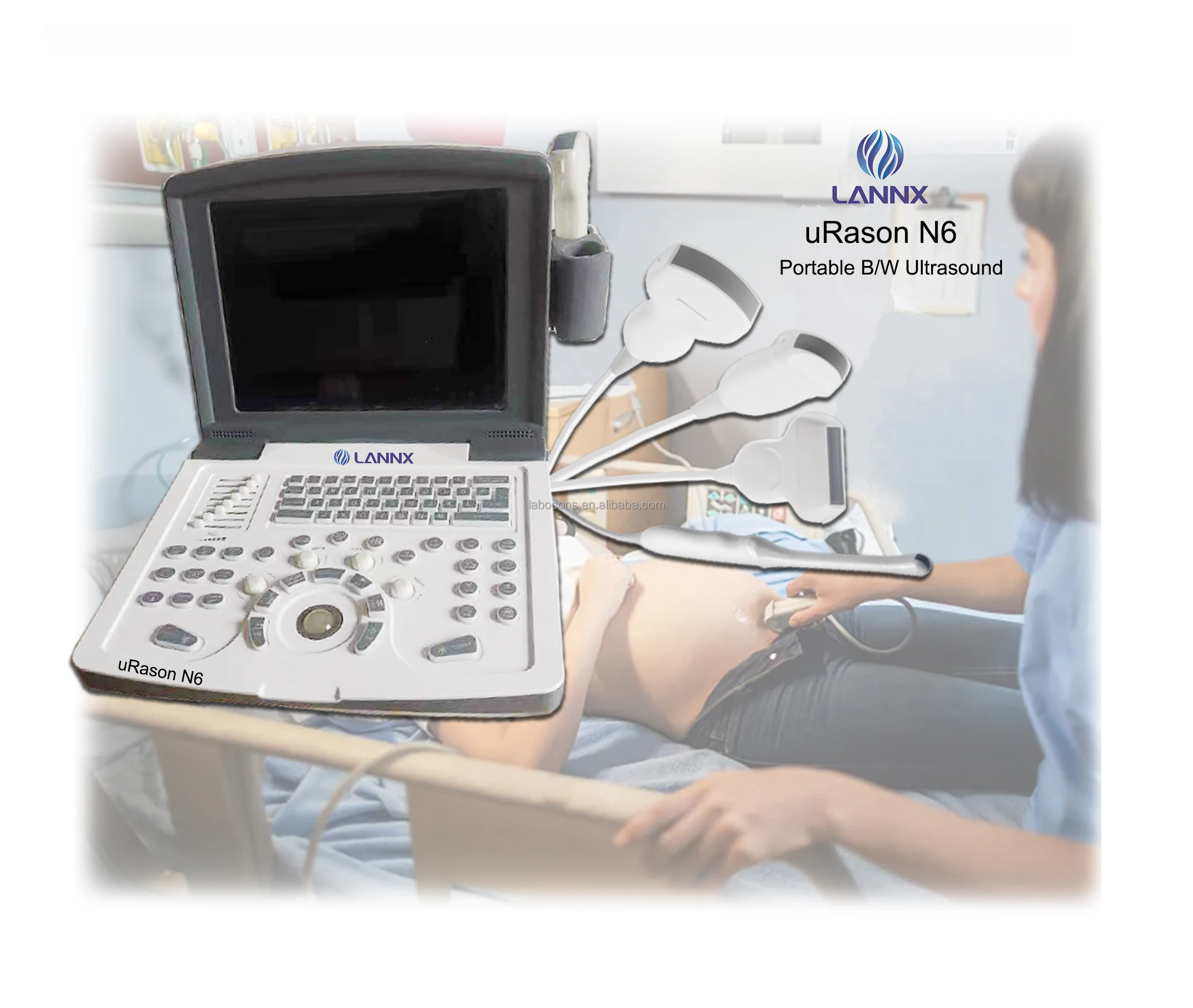 LANNX uRason N6 Priced to sell Ultrasonic Diagnostic System B/W Ultrasound Machine High-definition display Echocardiography