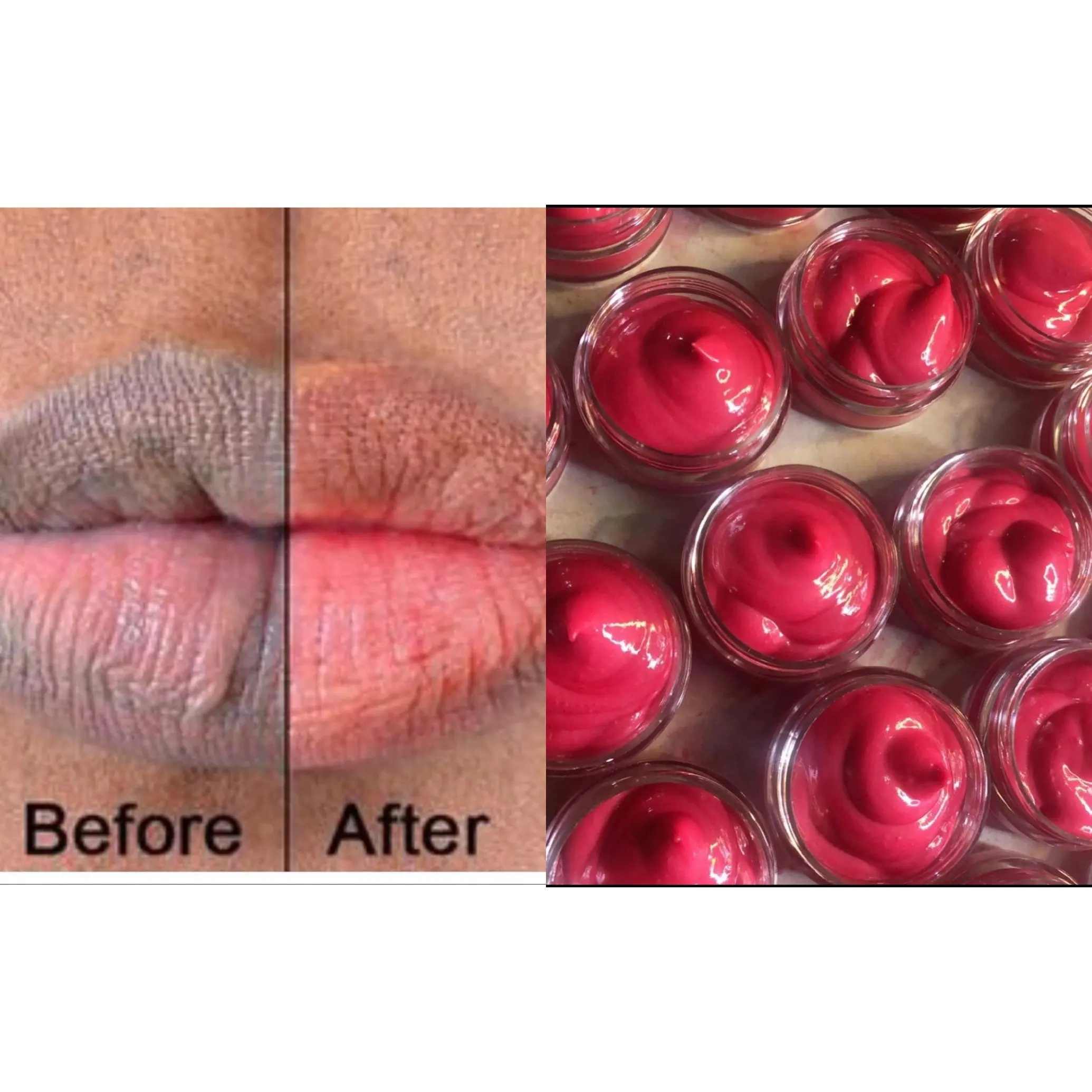 Natural Pink Llip  balm Lips Lightening Cream Lip Cream for black lips
