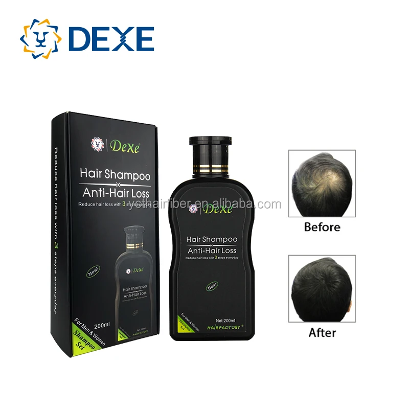 Dexe Anti Hair Loss Shampoo professional ginger anti hair loss treatment