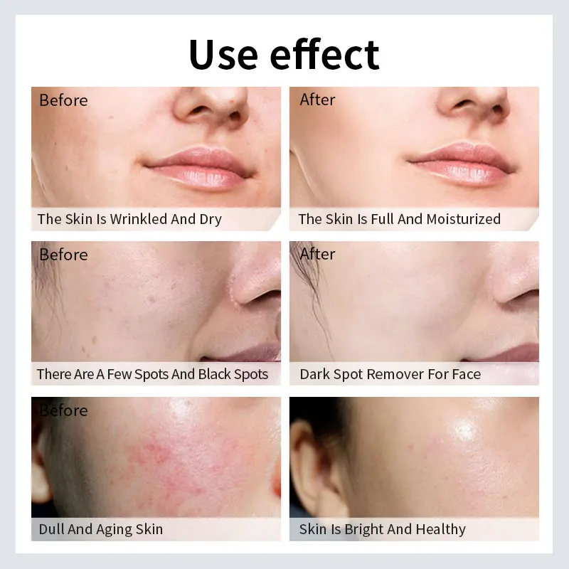 100% Natural Vegan Firming Nourishing Face Skin Care Essential Oil Anti-aging Repair Capsule Serum