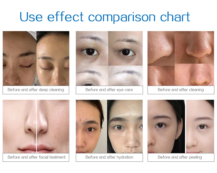 Top Quality 14 in 1 Beauty Facial Equipment Salon Facial Deep Cleaning Machine