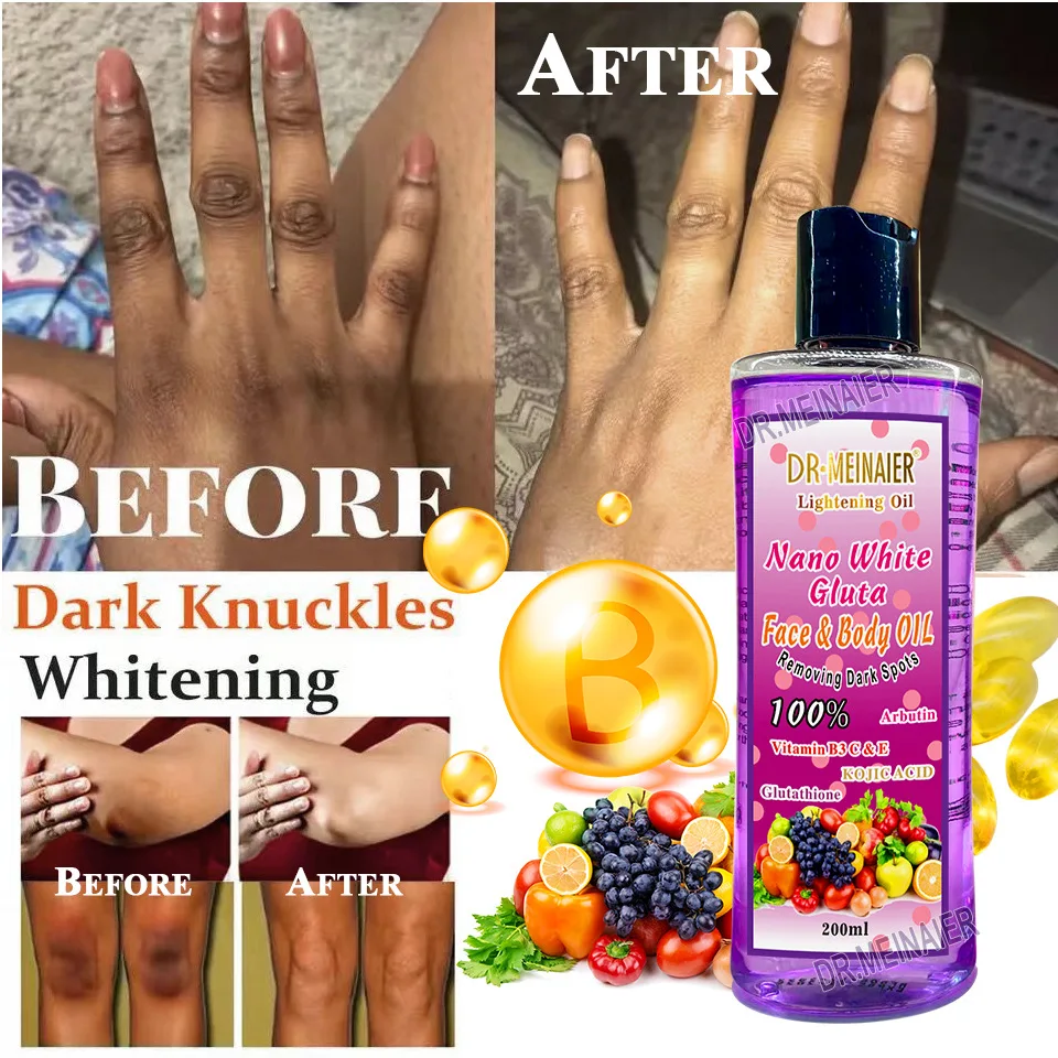 100%Pure Natural Lightening body Oil Gluta Arbutin Face & Body Skin Care  Whitening Hydrating Kojic Acid Vitamin Essential Oil
