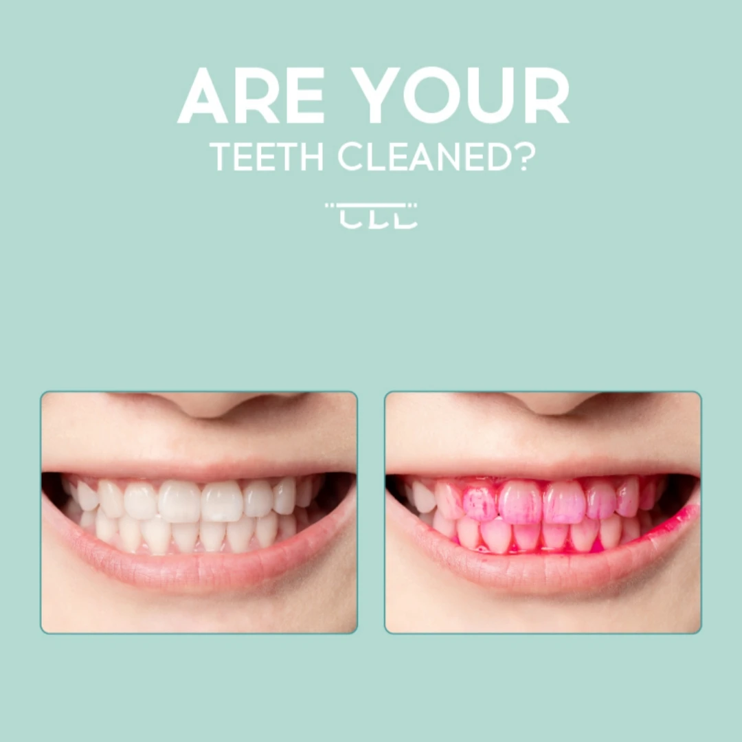 OEM Oral Hygiene Test Plaque Disclosing Liquid Indicator for Adults and Children