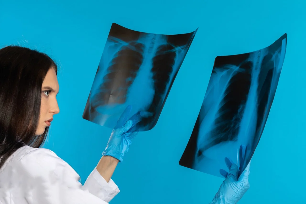 175mic 215mic High Definition  Medical imaging CT DR inkjet blue film medical x-ray pet film A3A4 transparent blue printing film