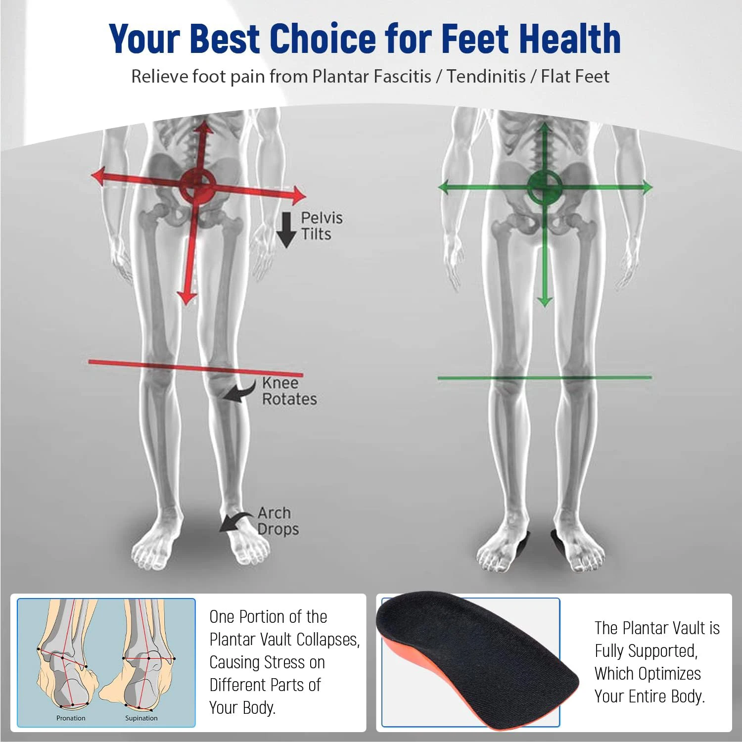 Plantar Fasciitis Relief Arch Support Shoe Inserts, Heel Cup for Heel Pain Relief, Achilles Tendonitis Relief and Max Anti-Shock