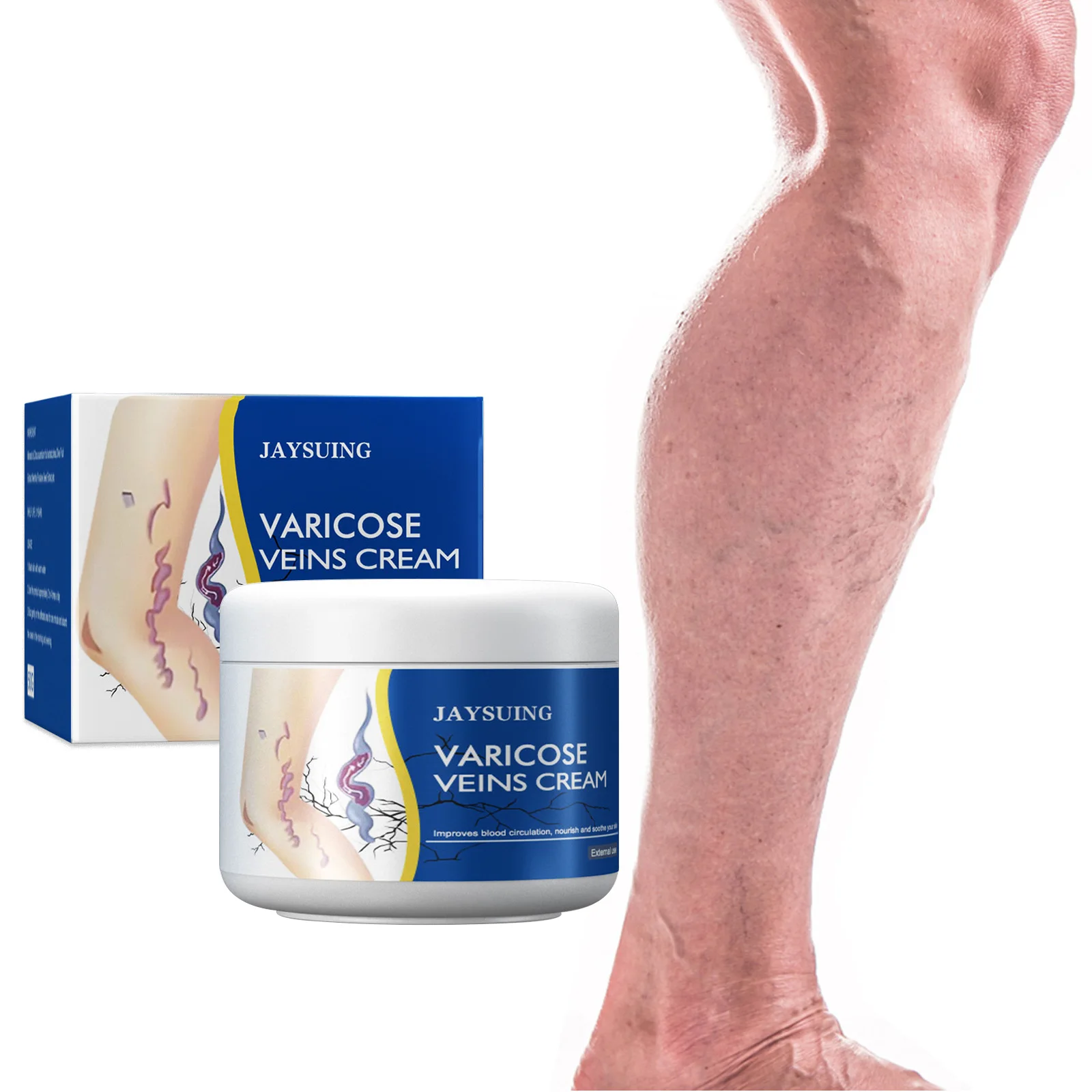 Jaysuing 50g Feet Varicose Veins Cream Treatment Relieve Dilated Capillaries Removal Phlebitis Spider Leg Veins Varicose Cream