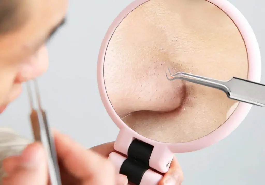 Customized 5PCS Blackhead Remover Ance Extractor Curved Blackhead Tweezer Kit Professional Stainless Pimple Blemish Removal Tool