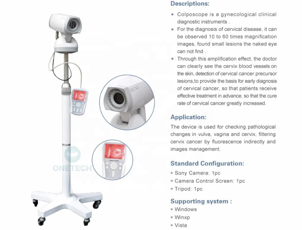 B42A Clearest Image Portable Electronic Colposcope color digital with CCD S ony Camera