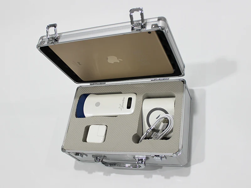 Мини ультразвуковой Беспроводной сканер портативный мини Wifi цветной допплер