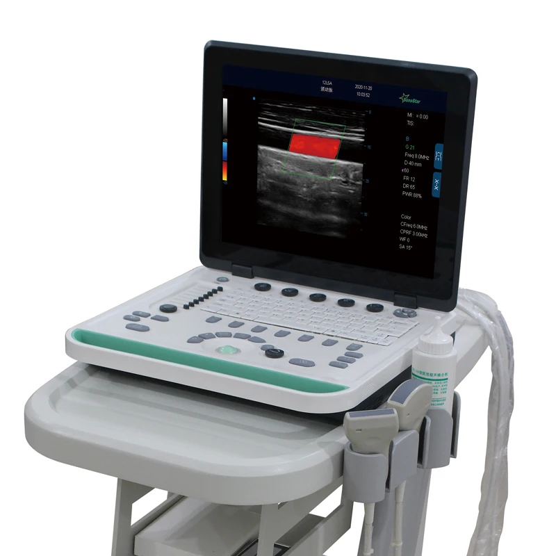 
C5Pre Portable Laptop Color Doppler Ultrasound Machine 