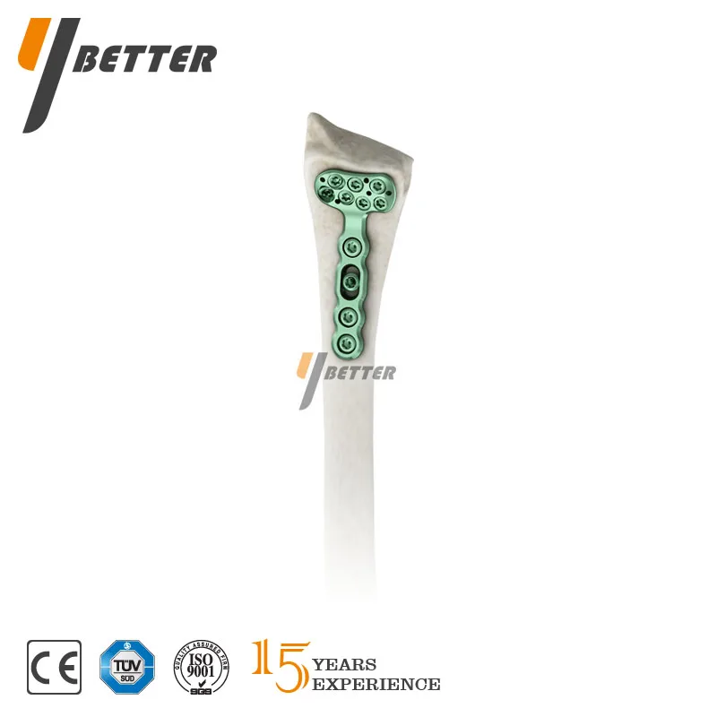 Youbetter Y-DVR Distal Radius Volar Plate Orthopedic Implants Instrument Set