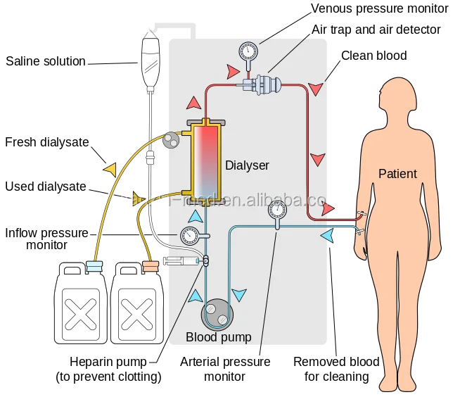 Dialysis dry A B powder for Hemodialysis
