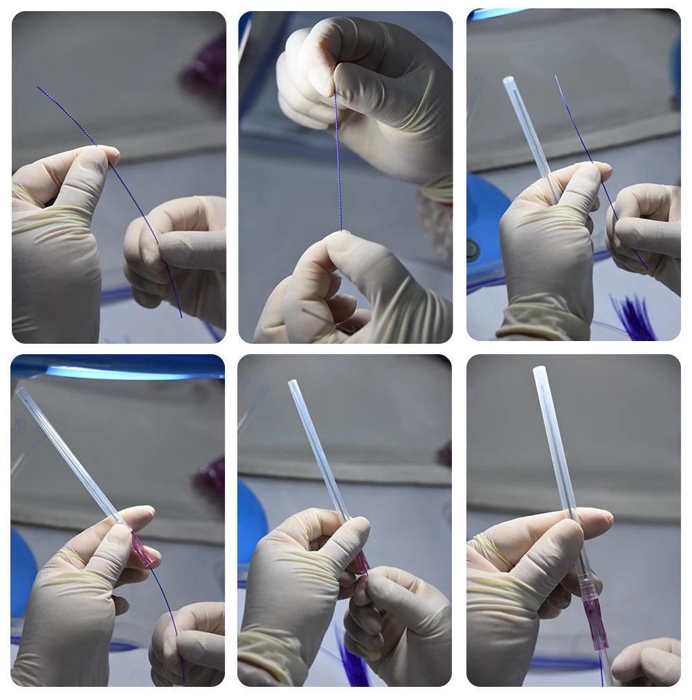 Korea 19G 410mm Facial Aesthetics Use Double Needle Korea Pdo Thread For Lifting