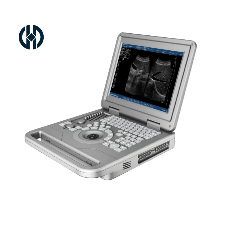 MH10-BW03 Medical Machine Notebook LCD Digital Ultrasound Scanner ultrasound medical ultrasound instruments machine