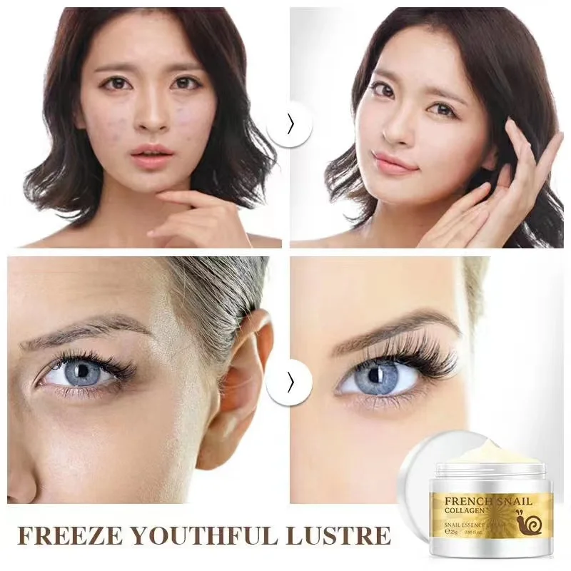 Private label Free sample lady snail repairing cream oily skin care dark spots and wrinkles removal face cream