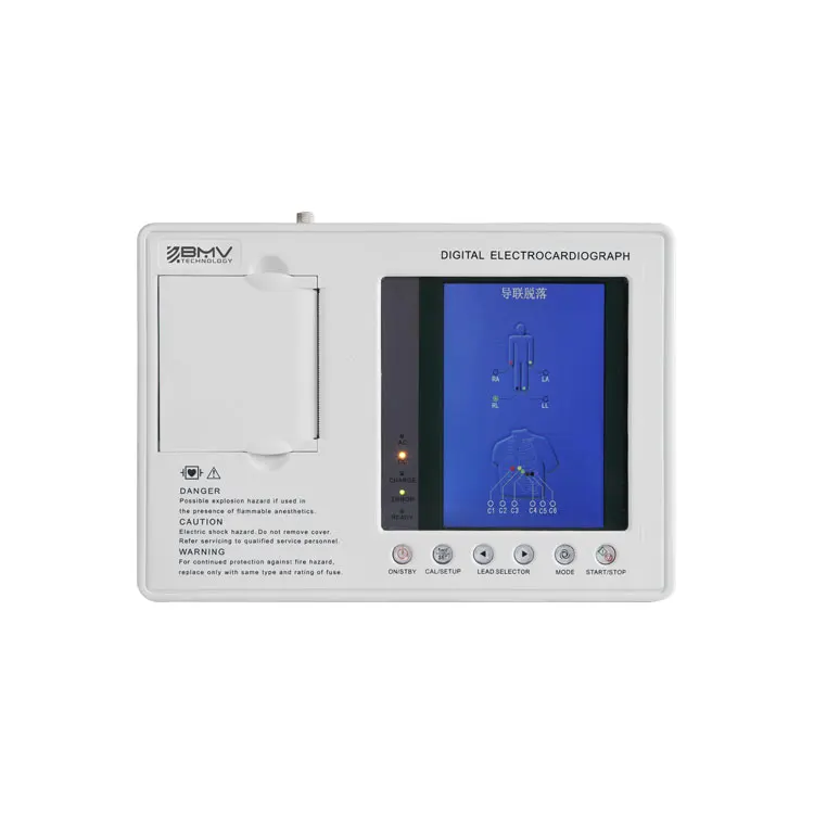 3 Channel portable veterinary ECG monitor machine 3 lead ecg monitor