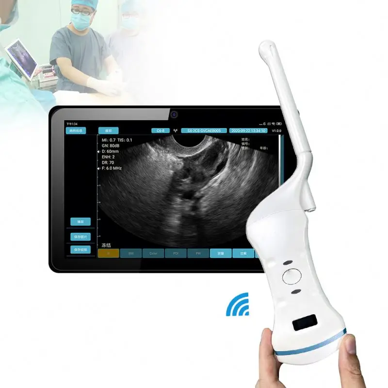 Medical Imaging Equipment Portable wireless wifi ultrasound scanner transvaginal ultrasound probe wireless