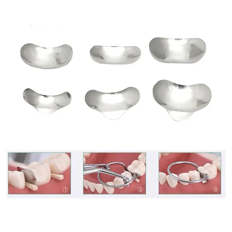 Hot Sales Dental Orthodontic Universal kit of Sectional Contoured Metal Matrices 100pcs/pack No.1398