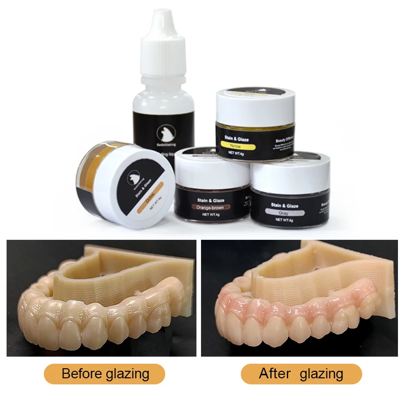 Оптовая продажа циркониевая глазурь и пятнистая паста стоматологические улучшенные визуальные свойства глазурные цвета лабораторное использование глазурная для зубного