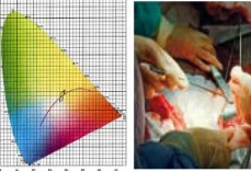 Double Dome LED Operating Light