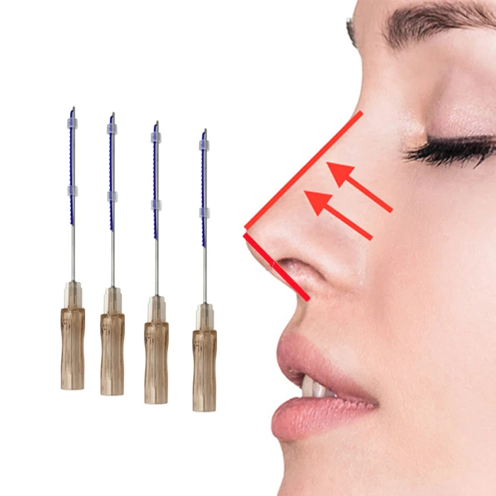Powerful Lifting Effect  PDO Thread 4d Cog Thread Mono Screw Thread For Anti Wrinkle And Ageless