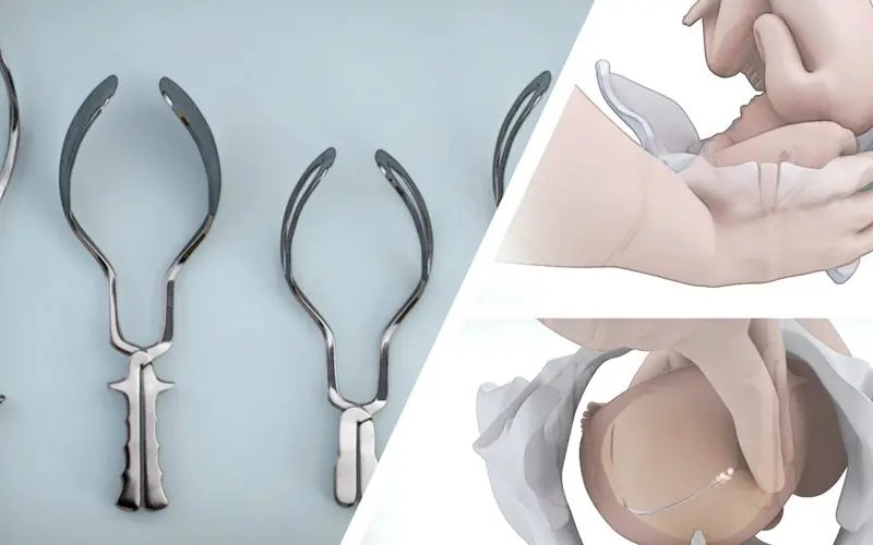 Hot sale  medical Cesarean section forceps Dedicated for cesarean section