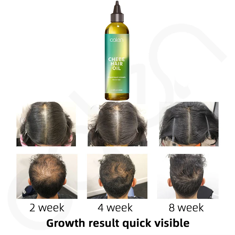 Oalen Wholesale Natural And Pure Nourishing Dry Scalp Hair Growth Chebe Hair Oil