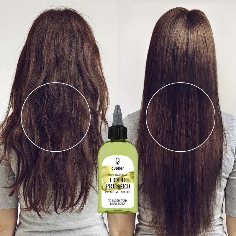Qquaker Hair Regrowth Oil Cold Pressed Wholesale Pure Plants Essential Oil For Hair Growth