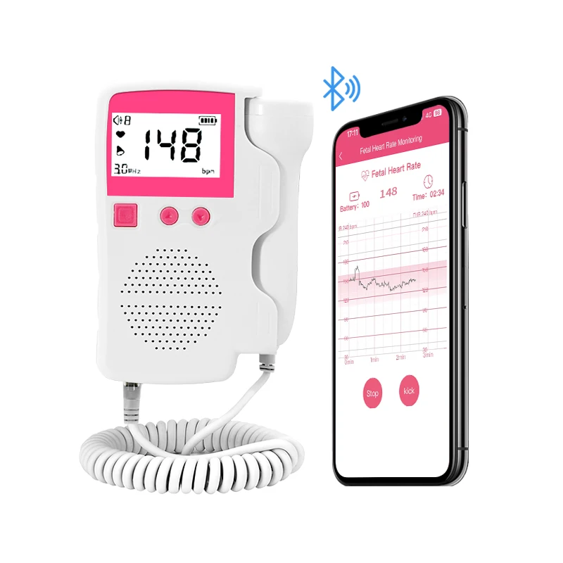 Mini Handheld Fetal Doppler CE certified Monitor Baby Heart Beat Doppler App Record Heart Rate