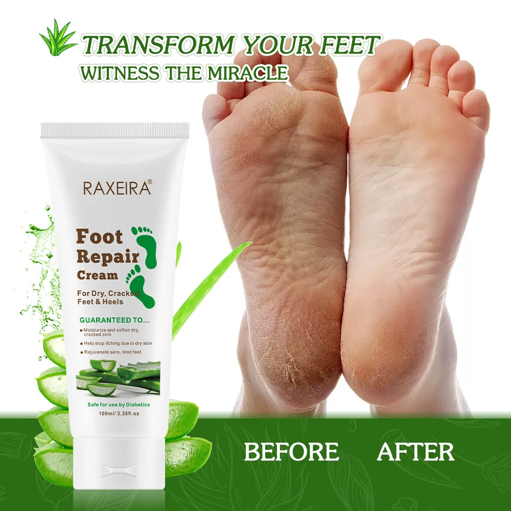 Oem Odm Foot Skin Repair Moisturizing Cream For Cracked Heels