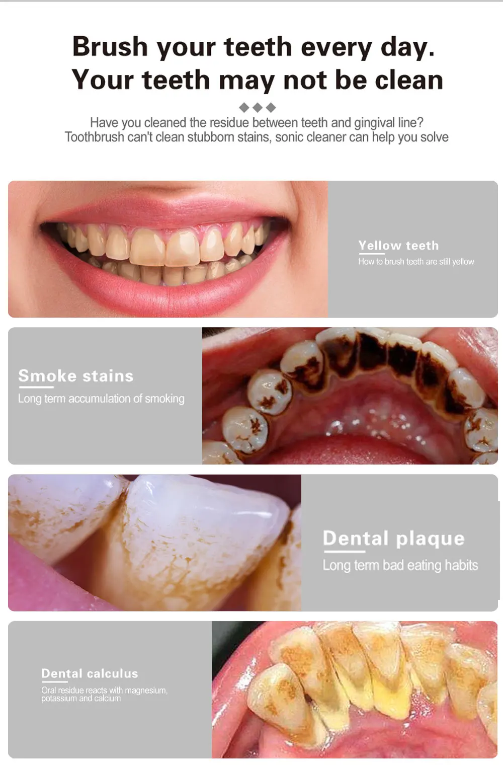 Electric Ultrasonic Dental Calculus Remover Teeth Cleaner Dental Cleaning Teeth Whitening Scaler Dental Tartar Remover