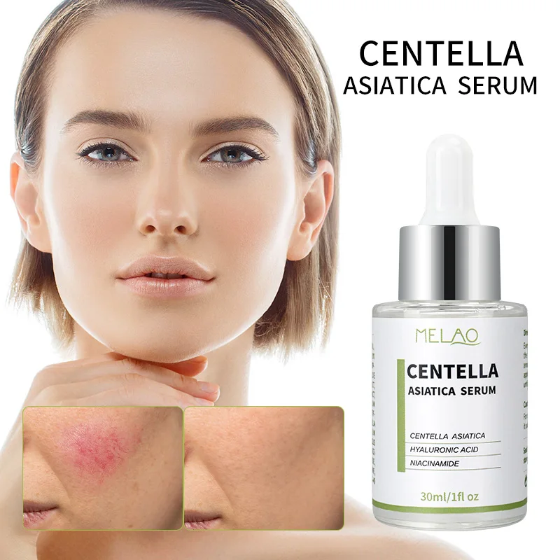 Custom Logo Rapid Soothing Skin Repair Oil Skin Face Serum Sebum Rebalancing Rx 131 Ampoule Minimize Sebum Serum