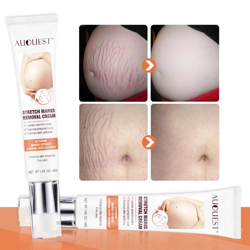 
Private Label Organic Herbal Acne Leg Deep Scar Removal Gel Anti Pregnancy Stretch Mark Removal Repair Cream 