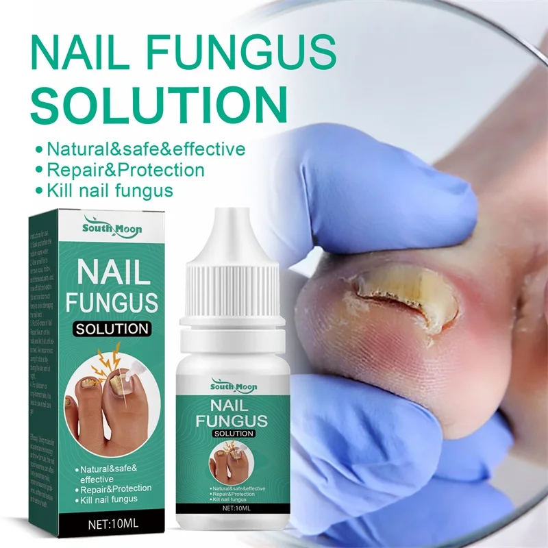 Organic Fungus Nail Repair Essence Toe nail Fungus Remover Treatment Solution