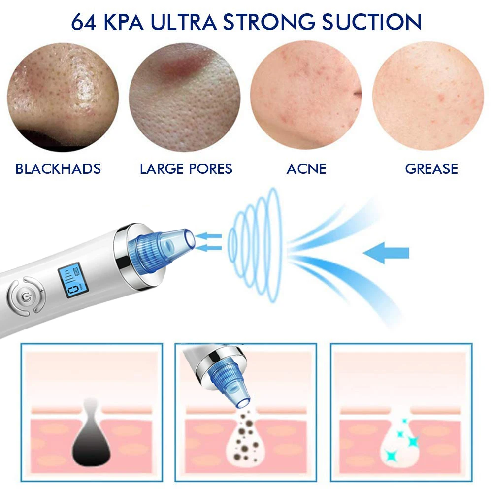 Blackhead Remover Other Vacuum Cleaners Suction Blackhead Beauty Salon Equipment