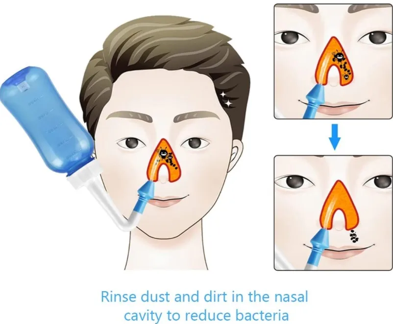 Neti кастрюля для мытья носа, промывка под давлением, орошение носа, промывка носа