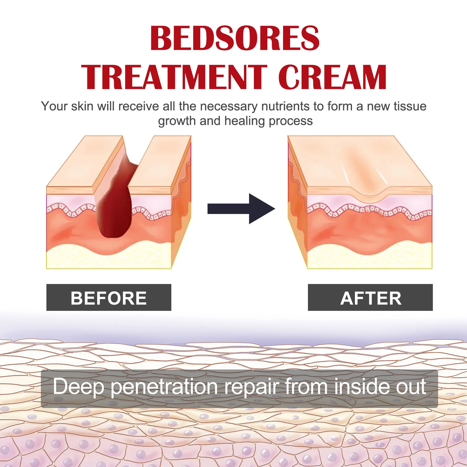 Private Label Fast Healing Bedsores Treatment Ointment Wound care Ointment Bedsores Cream Body Care Cream 20g