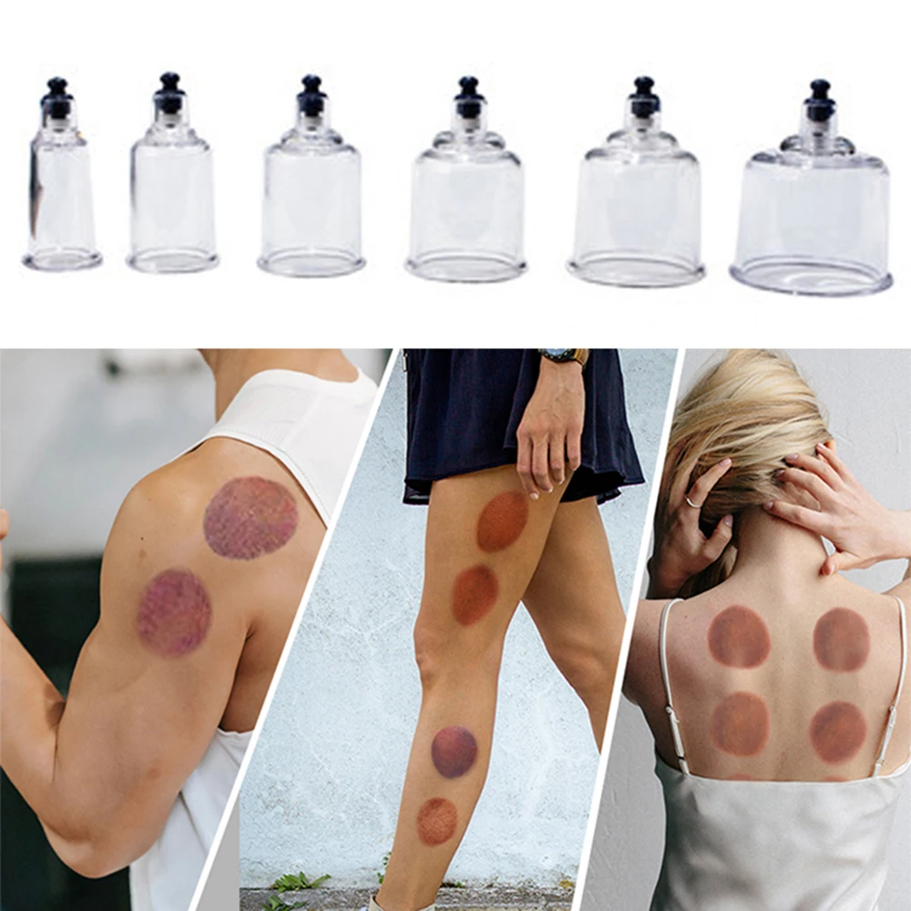19 Cupping Cups Hijama Cups Vacuum Cupping Set Vacuum Cupping Massage Therapy Cups