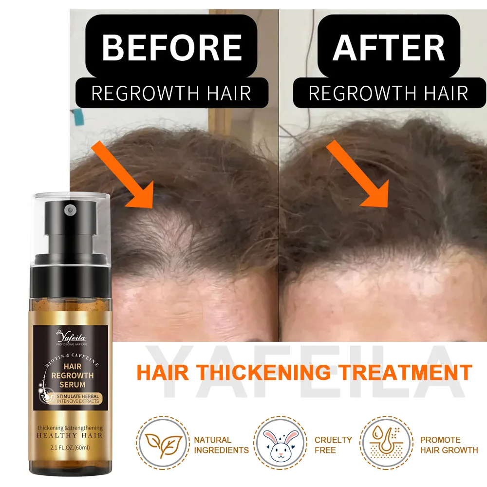 Factory Bulk 60ml Biotin Hair Growth Spray for Men and Women Fast Regrowth Treatment Serum to Stop Hair Loss