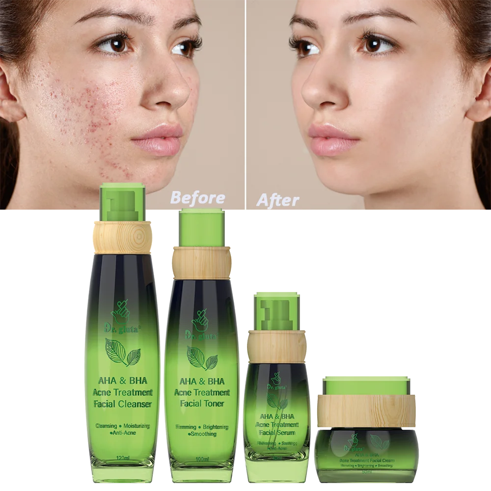 Extra Strength Acne Kit, 2% Salicylic Acid & 5% Benzoyl Peroxide for Severe Acne, Redness Relief Acne Treatment Repairing Acne