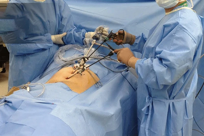 Single Use Transparent Color  Endoscope Laparoscopic Camera Cover