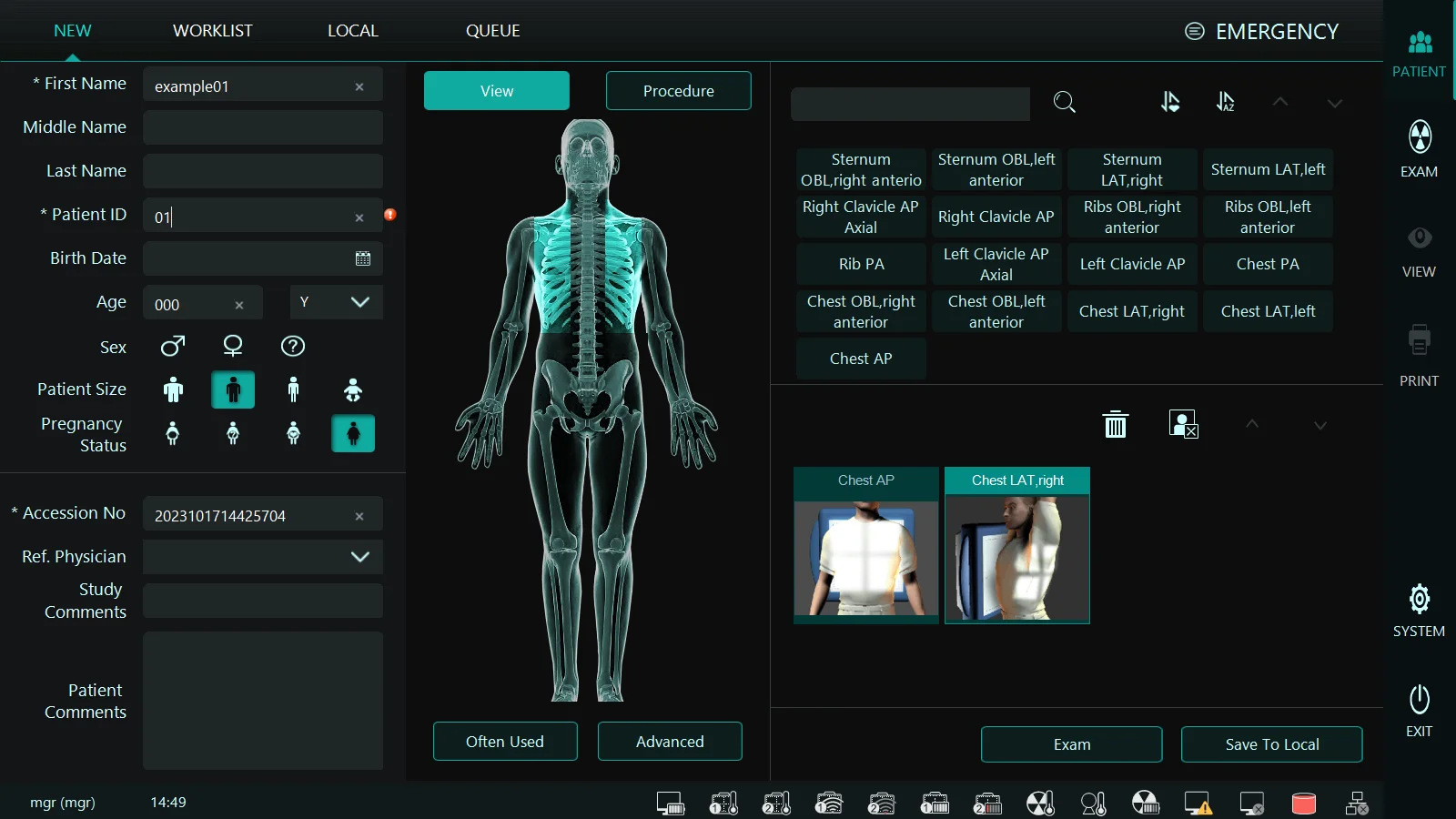 Affordable 14*17/17*17 rx portatil x-ray machine digital x-ray flat panel detector x-ray