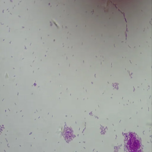 Medical Microbiology Slides Microscope Slides 100pcs Educational Prepared Slides Medical Microbiology Education