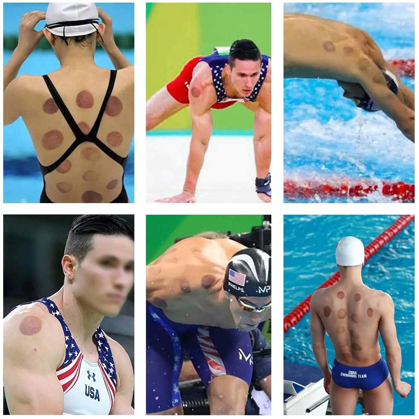 Chinese Body Cupping  Hijama Vacuum Cupping Set