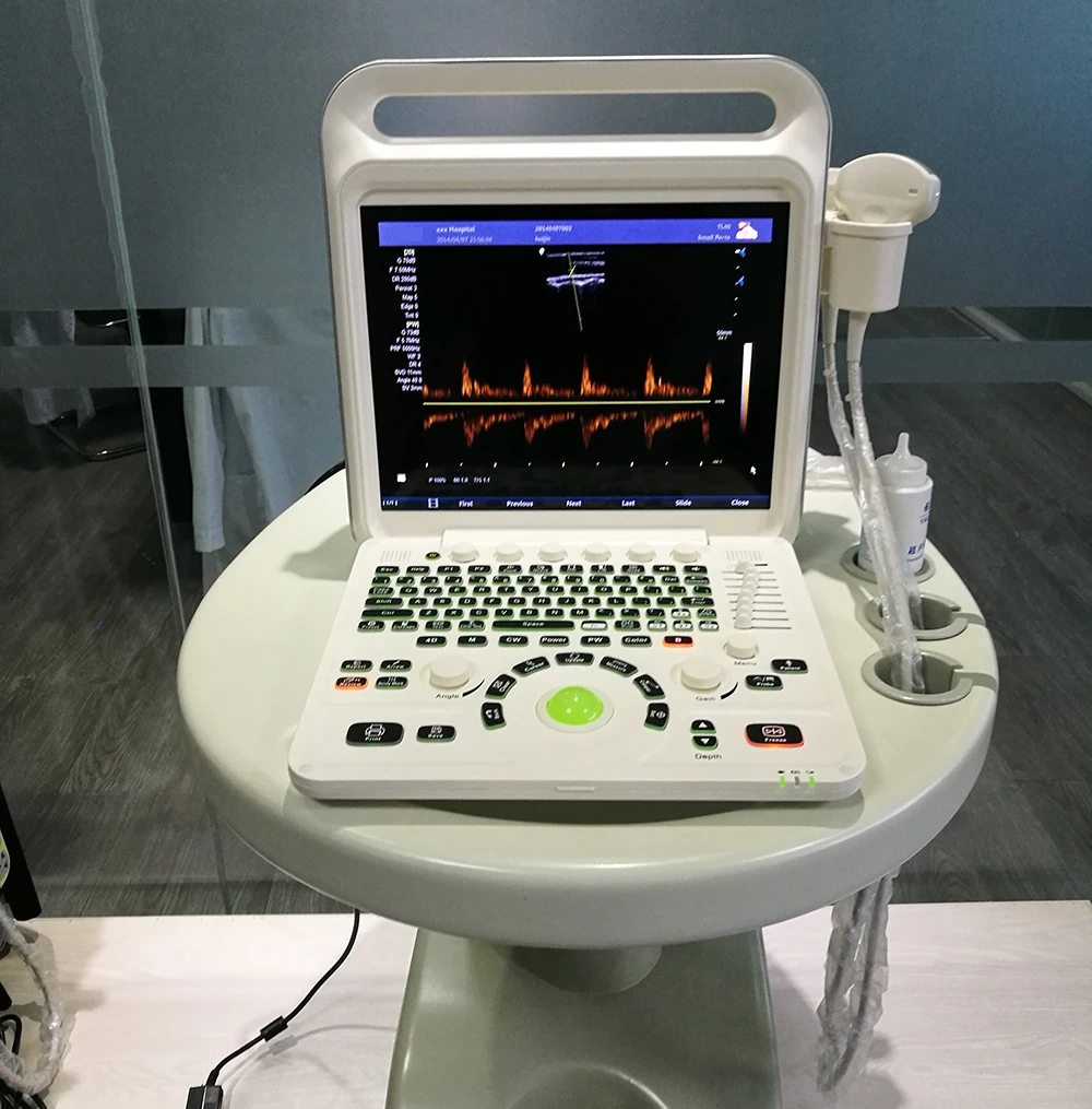 MHz 4D volumetric Portable notebook Color Doppler double probes ultrasound machine with 15 inches LCD monitor E60