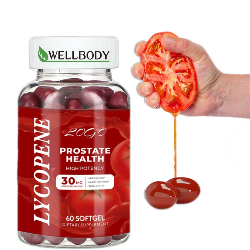 WELLBODY OEM/ODM простаты в капсулах для мужчин корень крапивы 11 1 травяной экстракт добавки softgels мужского здоровья