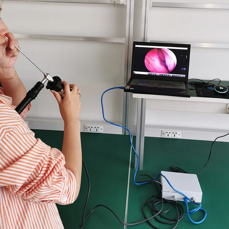 medical hd usb endoscope camera usb video laryngoscopy system