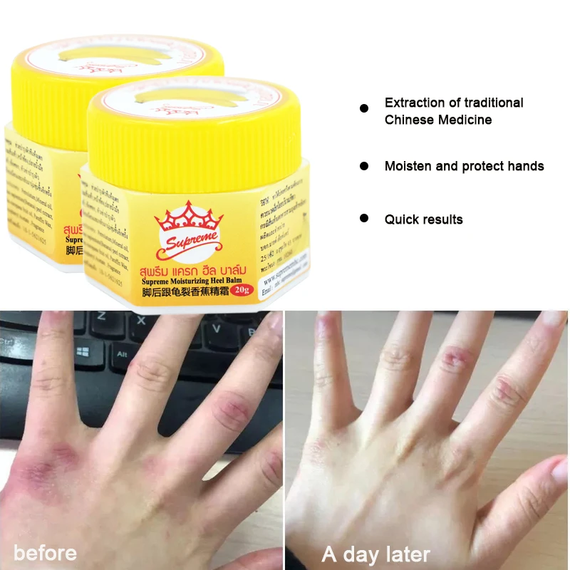 20g Skin Crack Healing Cream Moisturizing Anti-drying Repair Chapped Cream Prevent Skin Cracked Chilblain Peeling Ointment