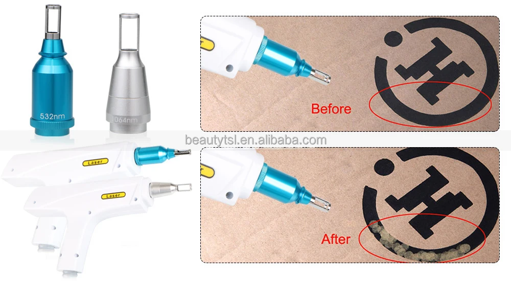 LINGMEI long pulse nd yag laser tattoo removal machine/portable mini nd:yag laser for sale/q switch nd yag laser